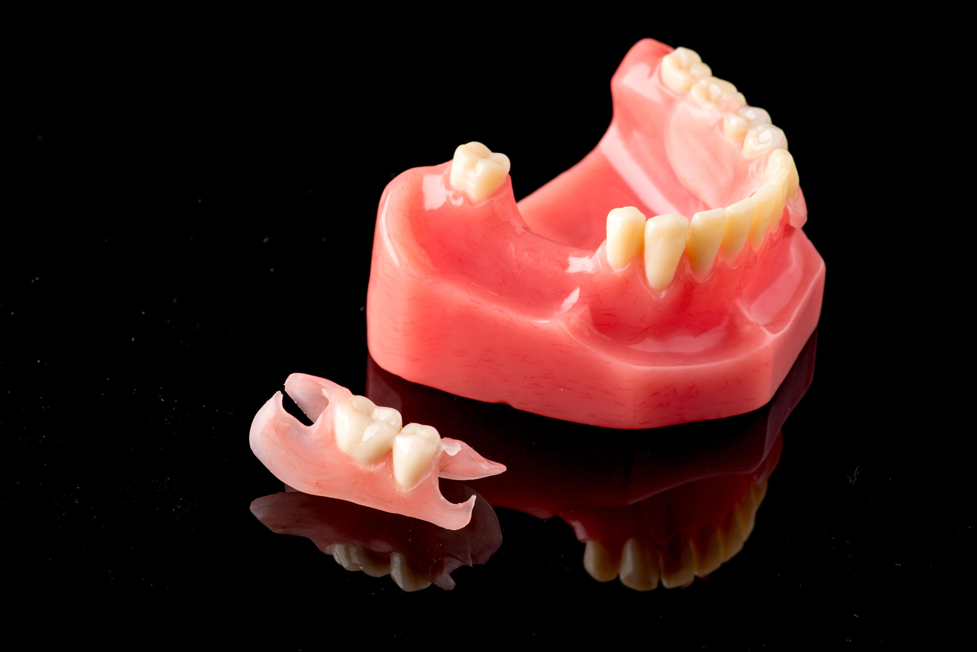 Prothèse dentaire en résine souple